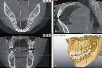 京都十条駅前歯科/京都市南区歯科